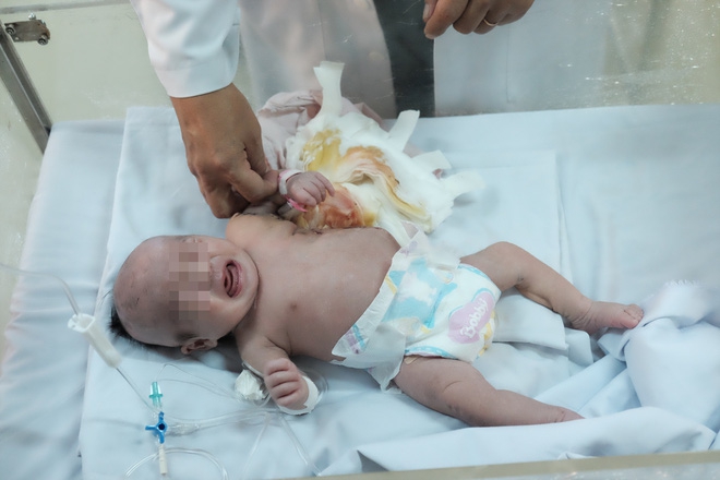 TP.HCM: Vừa chào đời, bé gái đã mang khối u khủng trên cơ thể khiến tính mạng nguy hiểm